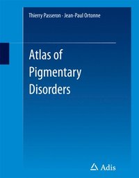 Atlas of Pigmentary Disorders (e-bok)