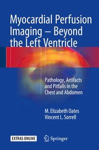 Myocardial Perfusion Imaging - Beyond the Left Ventricle (inbunden)