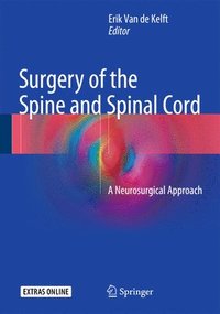 Surgery of the Spine and Spinal Cord (inbunden)