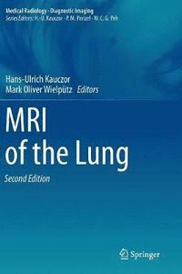 MRI of the Lung (inbunden)