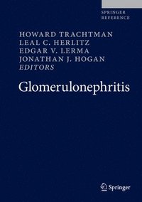 Glomerulonephritis Howard Trachtman Leal C Herlitz Edgar V Lerma Jonathan J Hogan Mixed Media Product Bokus