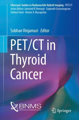PET/CT in Thyroid Cancer (hftad)