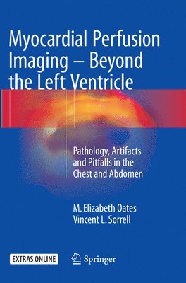 Myocardial Perfusion Imaging - Beyond the Left Ventricle (hftad)