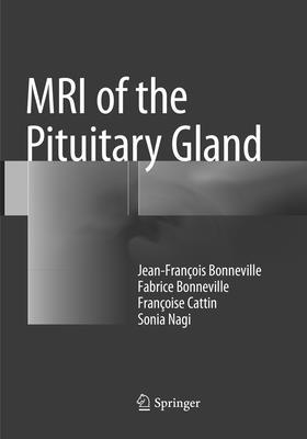 MRI of the Pituitary Gland (inbunden)