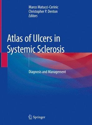 Atlas of Ulcers in Systemic Sclerosis (inbunden)