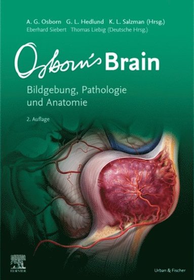 Osborn''s Brain (h�ftad)
