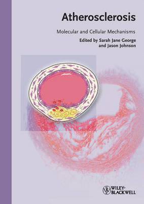 Atherosclerosis (inbunden)