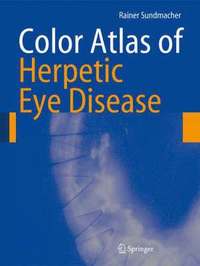 Color Atlas of Herpetic Eye Disease (inbunden)