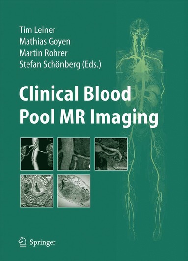 Clinical Blood Pool MR Imaging (inbunden)