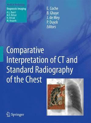 Comparative Interpretation of CT and Standard Radiography of the Chest (inbunden)