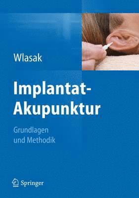 Implantat-Akupunktur (häftad)