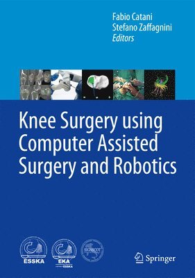 Knee Surgery using Computer Assisted Surgery and Robotics (inbunden)