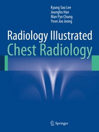 Radiology Illustrated: Chest Radiology (e-bok)