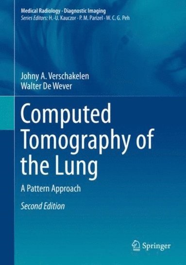 Computed Tomography of the Lung (e-bok)