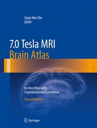 7.0 Tesla MRI Brain Atlas (inbunden)