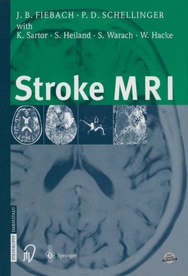Stroke MRI (hftad)