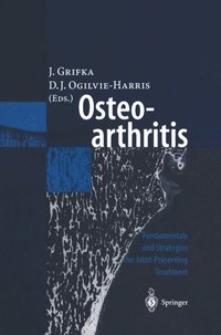 Osteoarthritis (e-bok)