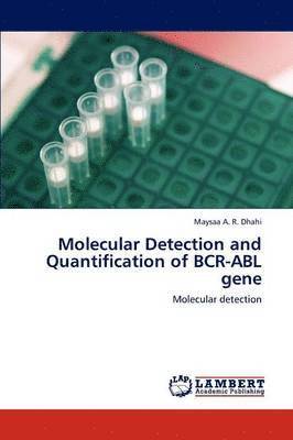 Molecular Detection and Quantification of Bcr-Abl Gene (hftad)