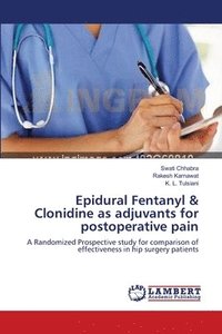 Epidural Fentanyl & Clonidine as adjuvants for postoperative pain (hftad)