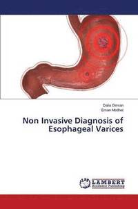 Non Invasive Diagnosis of Esophageal Varices (hftad)