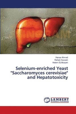 Selenium-enriched Yeast "Saccharomyces cerevisiae" and Hepatotoxicity (hftad)