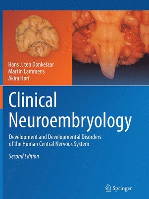 Clinical Neuroembryology (hftad)