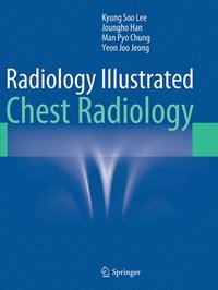 Radiology Illustrated: Chest Radiology (hftad)