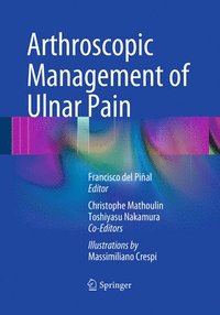 Arthroscopic Management of Ulnar Pain (hftad)