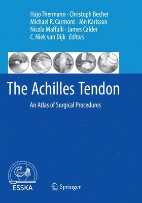 The Achilles Tendon (hftad)