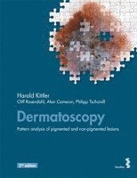 Dermatoscopy: Pattern analysis of pigmented and non-pigmented lesions (hftad)