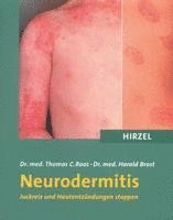 Neurodermitis (hftad)