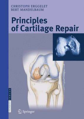 Principles of Cartilage Repair (häftad)