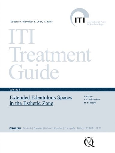 Extended Edentulous Spaces in the Esthetic Zone (häftad)