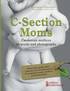 C-Section Moms - Caesarean mothers in words and photographs