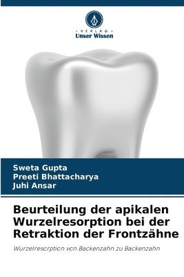 Beurteilung der apikalen Wurzelresorption bei der Retraktion der Frontzhne (inbunden)