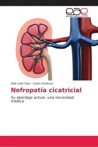 Nefropatia cicatricial (häftad)