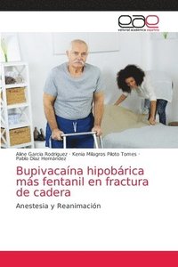 Bupivacaina hipobarica mas fentanil en fractura de cadera (häftad)
