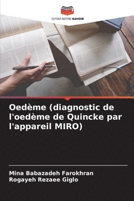 Oedème (diagnostic de l'oedème de Quincke par l'appareil MIRO) (inbunden)