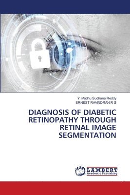 Diagnosis of Diabetic Retinopathy Through Retinal Image Segmentation (h�ftad)