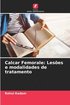 Calcar Femorale