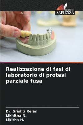 Realizzazione di fasi di laboratorio di protesi parziale fusa - Srishti ...
