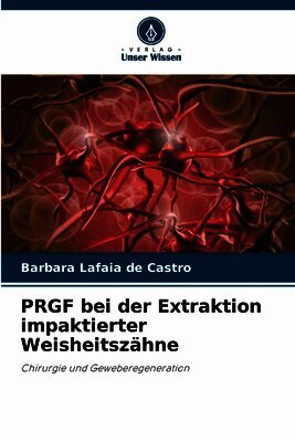 PRGF bei der Extraktion impaktierter Weisheitsz�hne (h�ftad)