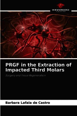 PRGF in the Extraction of Impacted Third Molars (h�ftad)