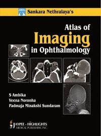 Atlas of Imaging in Ophthalmology (inbunden)
