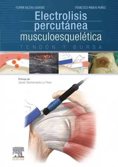 Electrolisis percutÃ¡nea musculoesquelÃ©tica - Ebok - Fermin Valera ...