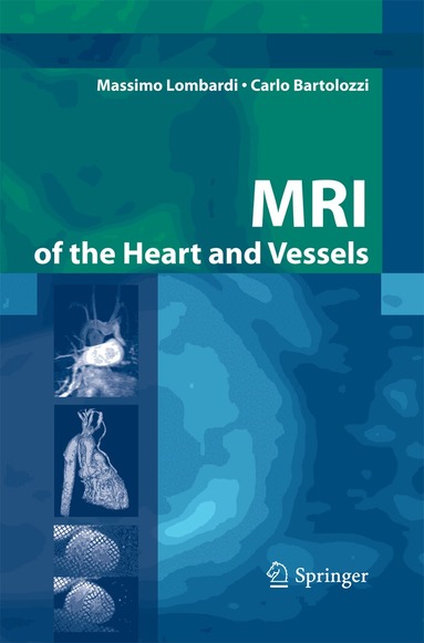 MRI of the Heart and Vessels (inbunden)