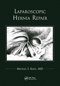 Laparoscopic Hernia Repair (inbunden)