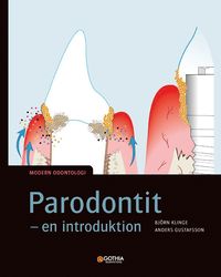 Parodontit : en introduktion (häftad)