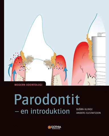 Parodontit : en introduktion (inbunden)