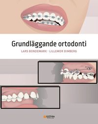 Grundlggande ortodonti (hftad)